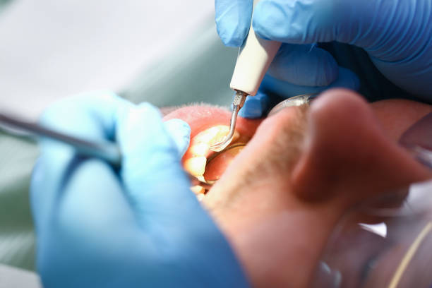 Tooth Infection Emergency Dentist in MT